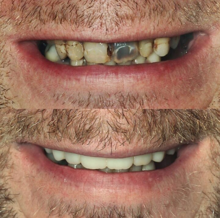 Treatment - Deansgate Dental Studio