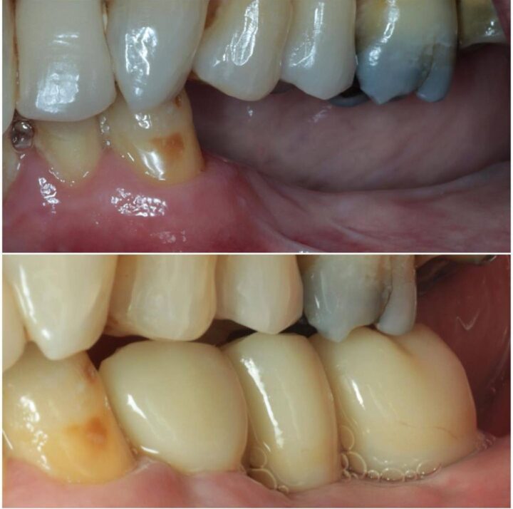 Treatment - Deansgate Dental Studio