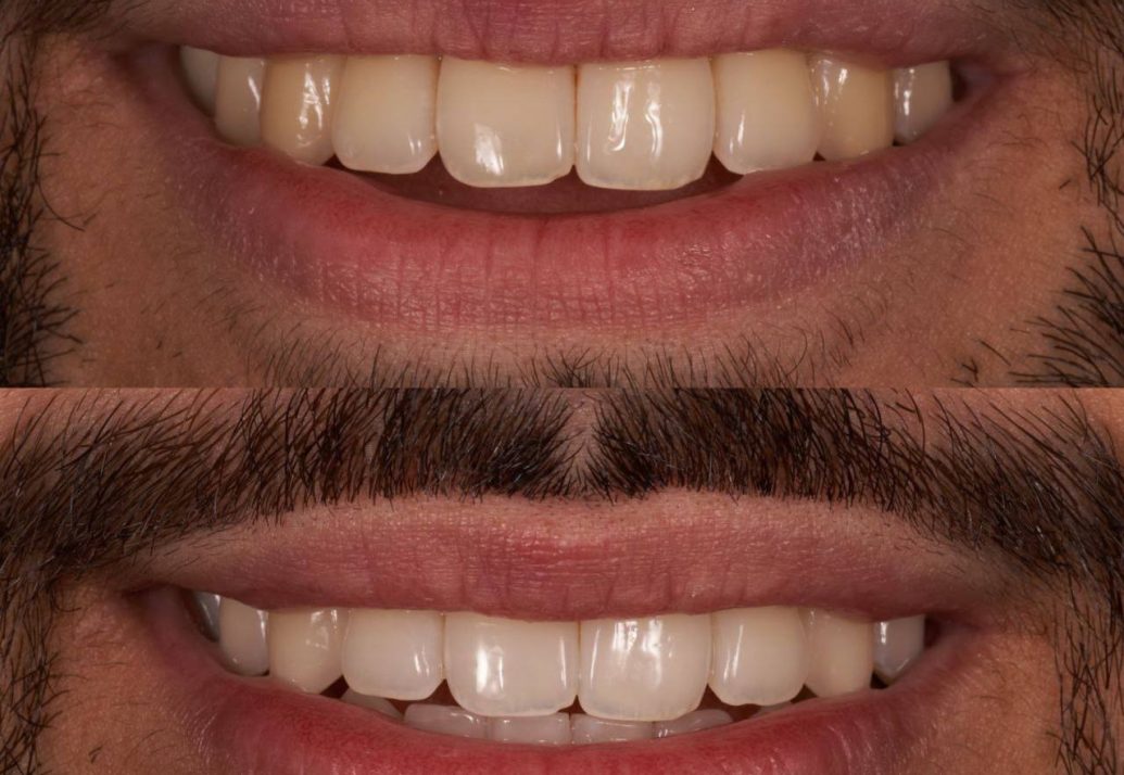blog - Deansgate Dental